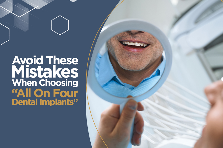 Avoid These Mistakes When Choosing “All On Four Dental Implants”
